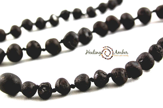 Amber Bracelet | 5.5 Inch